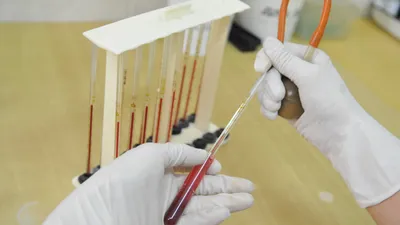 Больница, поликлиника, медицинское учреждение, медучреждение, врачи, доктора, сдача крови, переливание крови, анализ, анализы, фото - Новости Zakon.kz от 20.08.2025 09:15