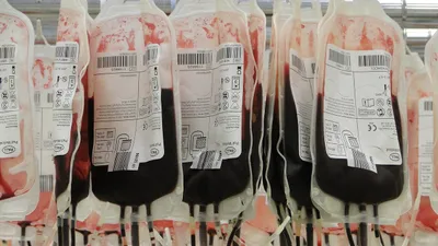 Переливание крови, фото - Новости Zakon.kz от 11.07.2025 05:20