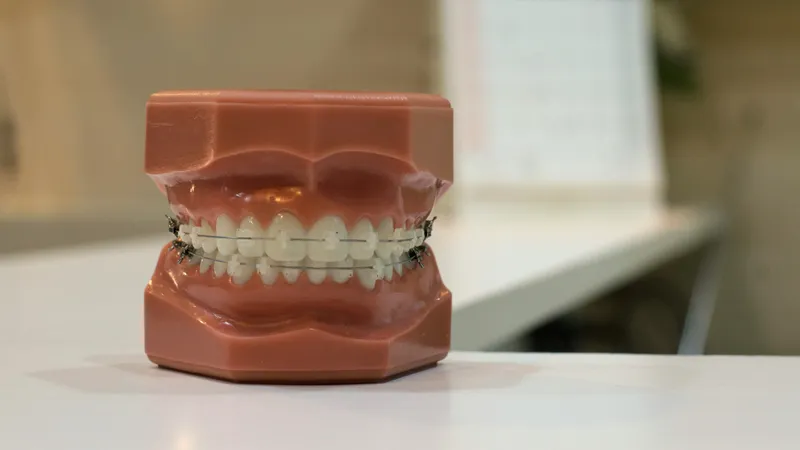 Как снизить риск развития кариеса с детства