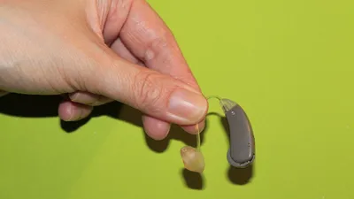 Слуховой аппарат в руках, фото - Новости Zakon.kz от 22.08.2025 11:17