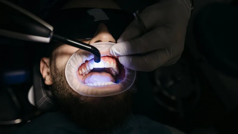 Лжестоматолог ставила американцам виниры, используя клей для ногтей