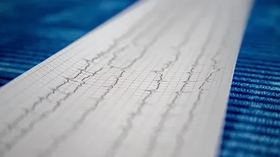 кардиограмма, фото - Новости Zakon.kz от 29.09.2025 12:17