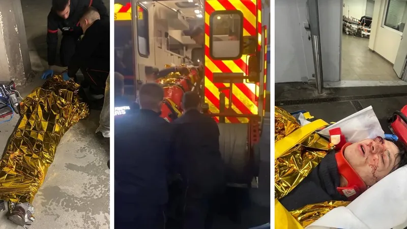 Участник "голой вечеринки" упал с высоты третьего этажа в Париже и попал в реанимацию