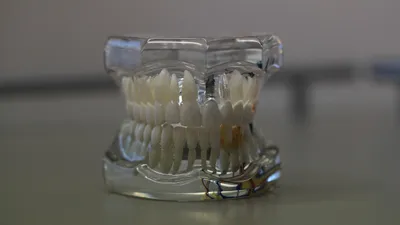 макет человеческой челюсти, фото - Новости Zakon.kz от 23.10.2025 13:50