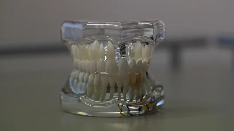 Человеческие зубы находят в сосисках и пельменях в Китае