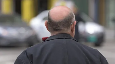 лысина, облысение, Тайвань, ученные, фото - Новости Zakon.kz от 27.10.2025 15:29