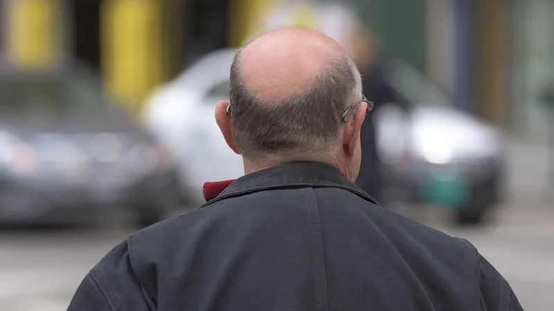 Ученые из Тайваня выяснили, что может помочь предотвратить выпадение волос