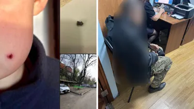 Ребенок, рана, задержанный мужчина , фото - Новости Zakon.kz от 26.11.2025 19:03