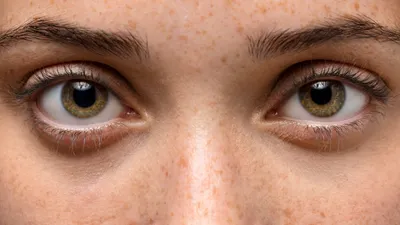 высокий уровень холестерина, фото - Новости Zakon.kz от 26.11.2025 20:48