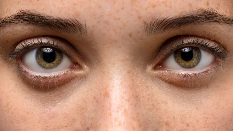 Кардиолог назвал внешние признаки скрытого холестерина