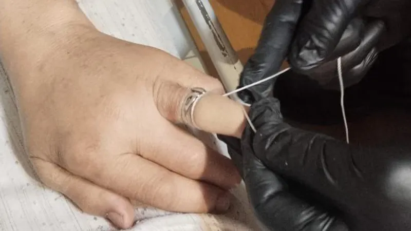 Жительница Талгара стала "пленницей" кольца