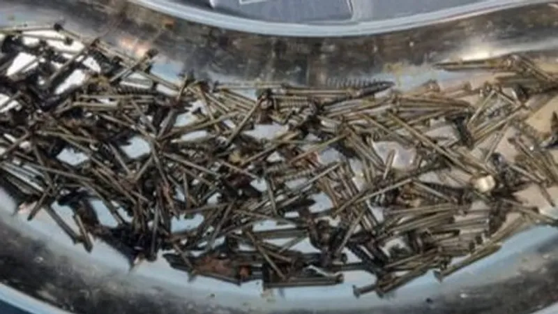 Из-за стресса и кредитов житель Узбекистана проглотил гвозди