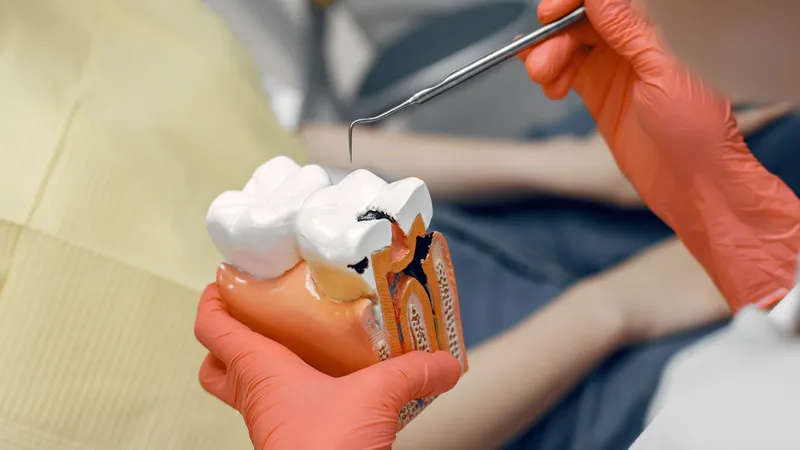 Какие продукты снижают риск заболевания десен