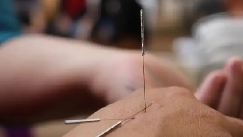 На иглотерапию пожаловались депутатам казахстанцы