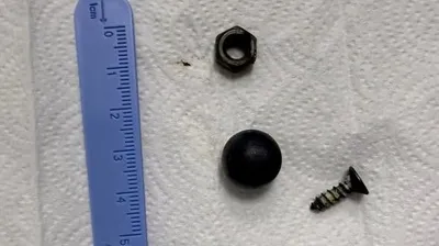 Магнит, винт и гайку проглотил ребенок в Шымкенте, фото - Новости Zakon.kz от 10.03.2026 19:17