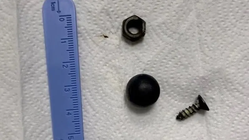 Магнит, винт и гайку проглотил ребенок в Шымкенте