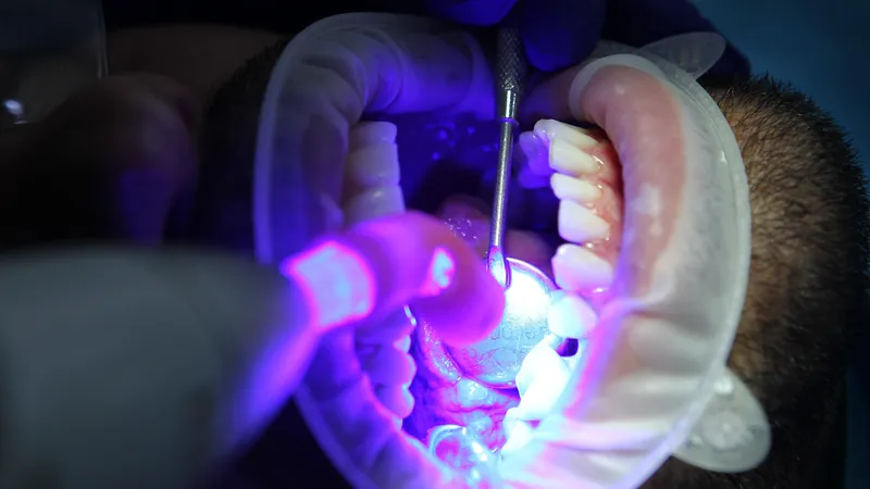 Названы главные провокаторы кариеса