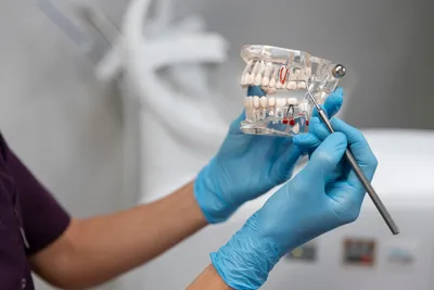 В Казахстане подорожало протезирование зубов: сколько надо копить на импланты